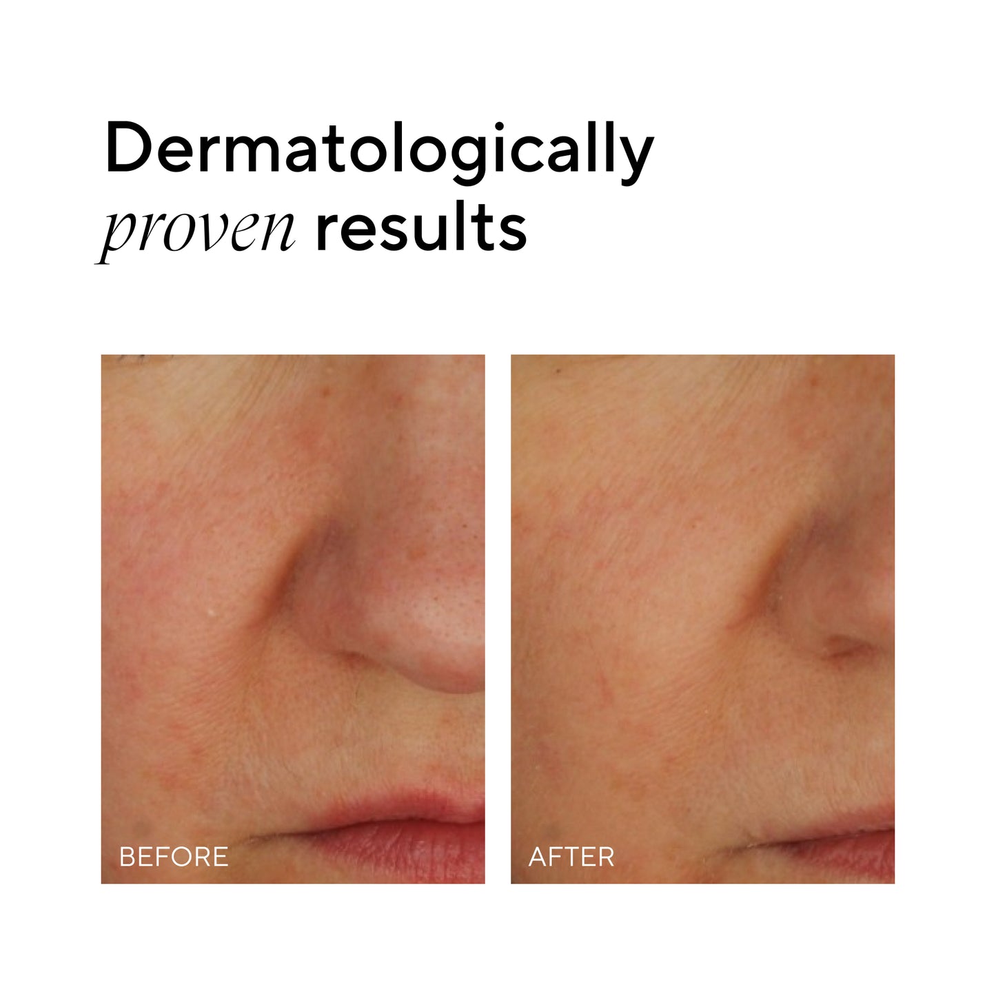 Madara SOS+ Sensitive Night Cream 70 ml - die Naturcosmetic