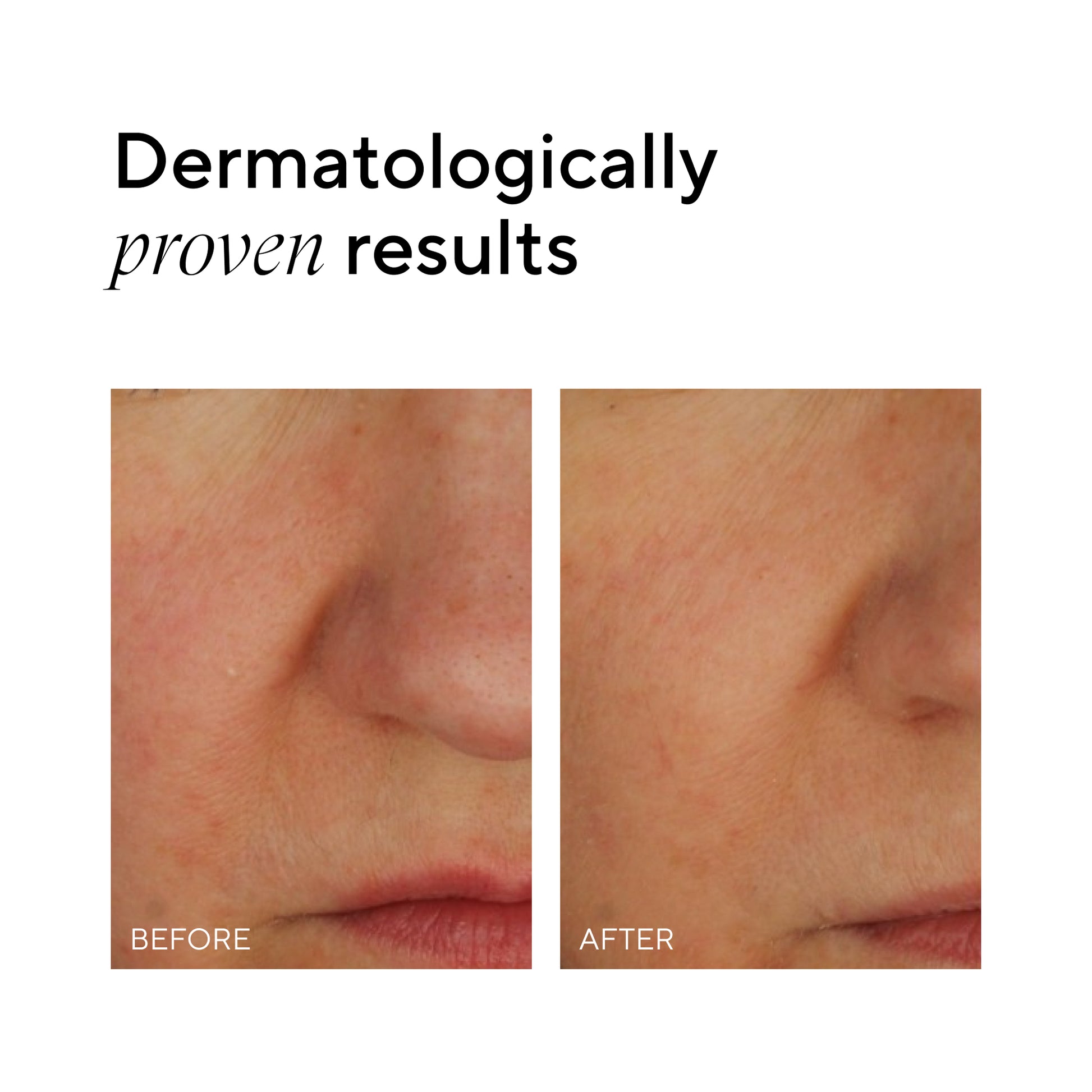 Madara SOS+ Sensitive Night Cream 70 ml - die Naturcosmetic